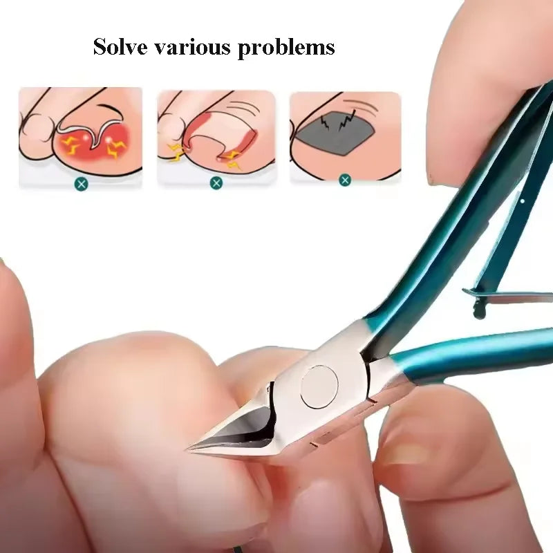 Professional Toenail Clipper – Ingrown & Thick Nail Trimmer