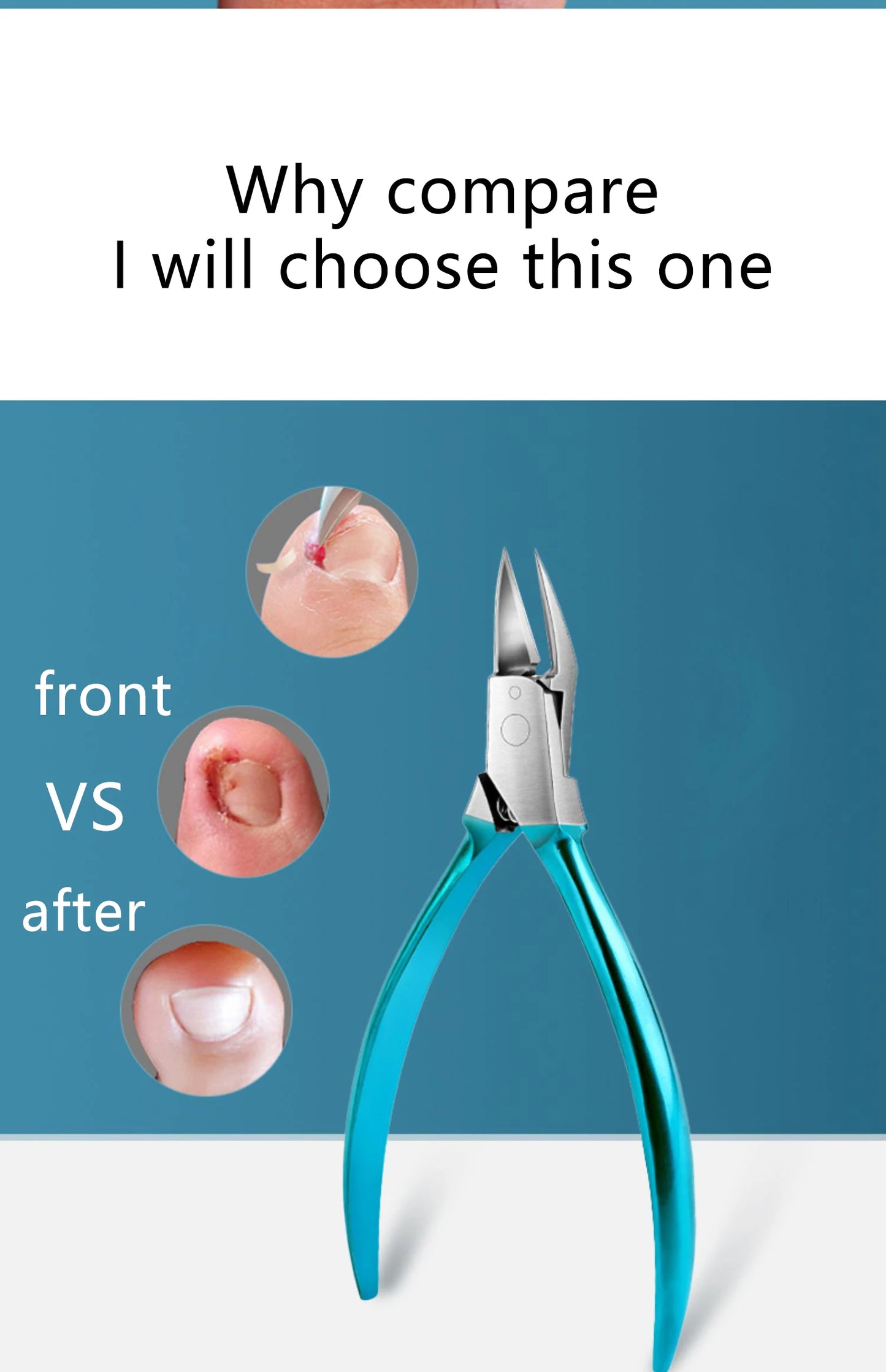 Professional Toenail Clipper – Ingrown & Thick Nail Trimmer