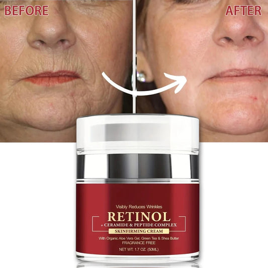 Instant Retinol Cream