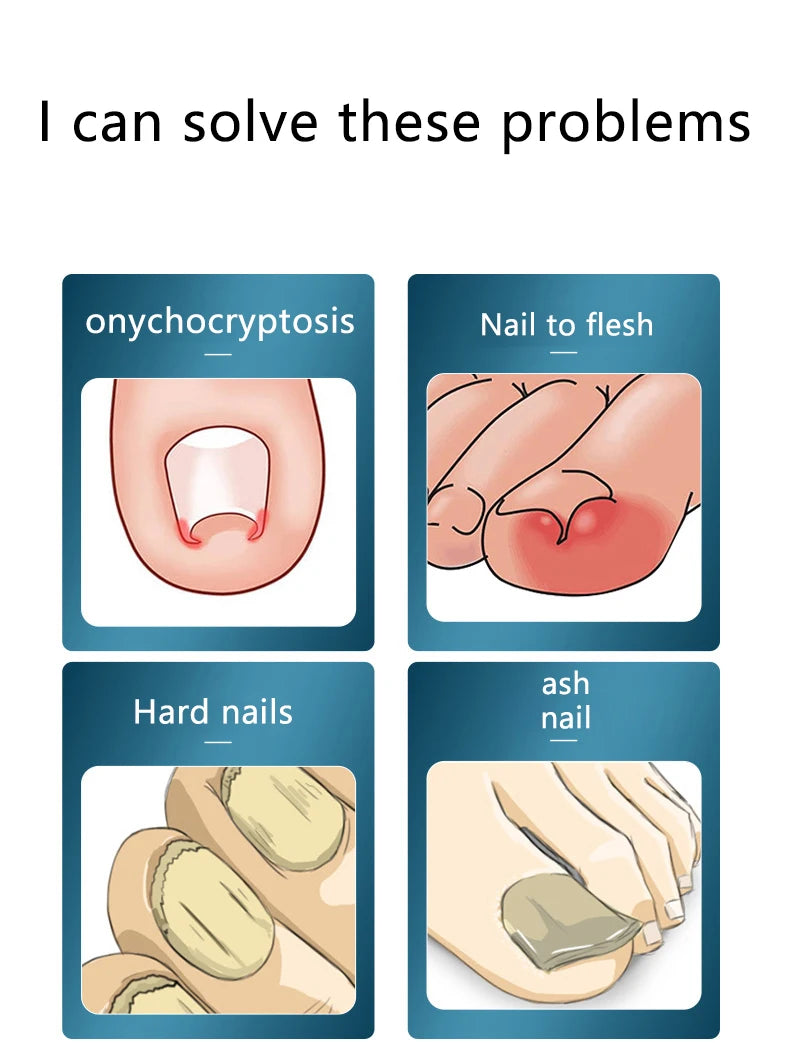 Professional Toenail Clipper – Ingrown & Thick Nail Trimmer